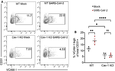 Caveolin-1 mediates neuroinflammation and cognitive impairment in SARS-CoV-2 infection