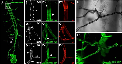 JAK/STAT Signaling Governs Airway Epithelial Homeostasis and Stress Resilience in Drosophila