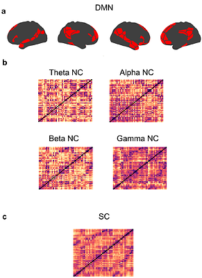 Multimodal cortical connectome in the default mode network across the adult lifespan