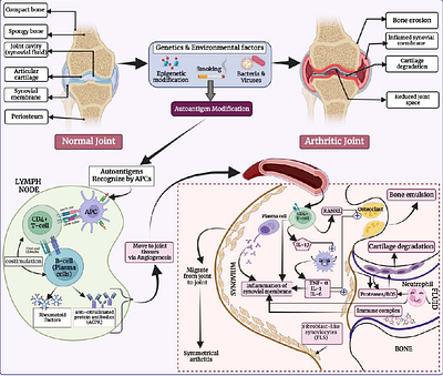In Silico Tool for Predicting and Scanning Rheumatoid Arthritis-Inducing Peptides in an Antigen