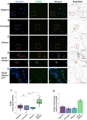 On the state of chromatin in mammalian sperm