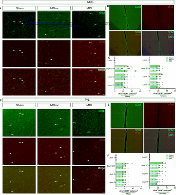 Rat mediodorsal thalamic subdivisions differentially modulate the sensory and affective components of pain through distinct prefrontal pathways.