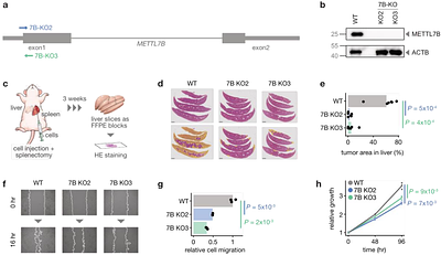 Thiol methyltransferase METTL7B coordinates lipid metabolism and promotes tumor progression in pancreatic cancer