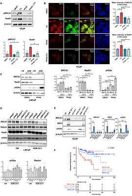 Functionality of BRCA1 supports the survival of prostate cancer cells during the development of castration resistance