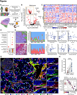 Fibroblast-derived Collagen VI shapes the structure and function of the tumor-immune microenvironment in clear cell renal cell carcinoma