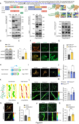 Kindlin-2-Moesin interaction orchestrates sprouting angiogenesis via modulating endothelial membrane mechanics and VEGF signaling