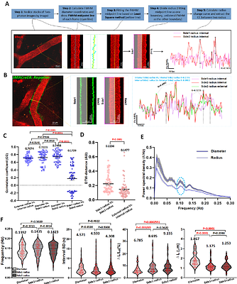 High-resolution vasomotion analysis reveals novel venous physiological features and progressive modulation of cerebral vascular networks by stroke