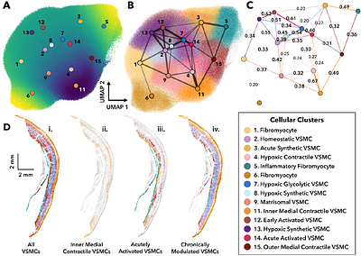 Cellular-Resolution Spatial Transcriptomics Reveals Laminar VSMC Phenotypic Remodeling and a Hypoxic Medial Core in Human Thoracic Aortic Dissection
