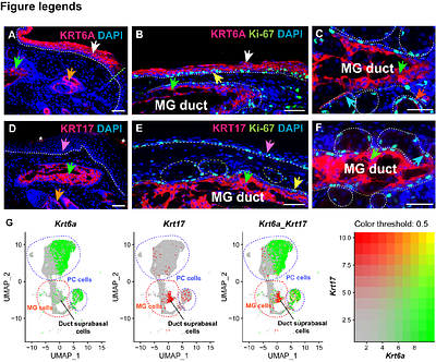 KRT6A and KRT17 mark distinct stem cell populations in the adult palpebral conjunctiva and Meibomian gland
