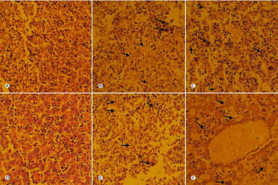 The Negative Effects of Smoking Cigarettes on Morphological and Histological Damages to 18 and 21 Days Mouse Embryo Liver