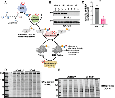 The denitrosylase SCoR2 controls cardioprotective metabolic reprogramming