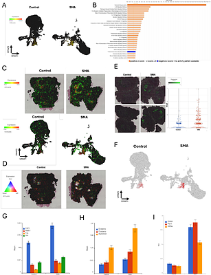 Spatial transcriptomics identifies dysregulated programs across neural and non-neural tissues in spinal muscular atrophy