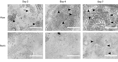 Collagen-Based Gut-on-Chip for in vitro modeling of intestinal barrier function and host-pathogen interactions