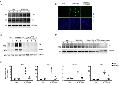 sPRR signaling in macrophages via the AT1R/Yap/Taz axis to induce renal fibrosis