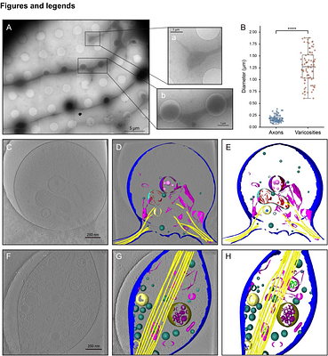 Spatial confinement shapes organelle architecture and remodeling in axons
