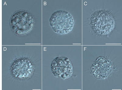 Characterization of the bacterial microbiome associated with centrohelid heliozoans from aquatic environments using full-length 16S rRNA PacBio sequencing