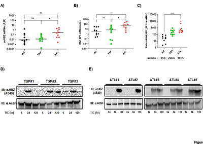 Antagonistic regulation of HBZ splicing by hnRNPA1 and hnRNPH1 drives HTLV-1 leukemogenesis.