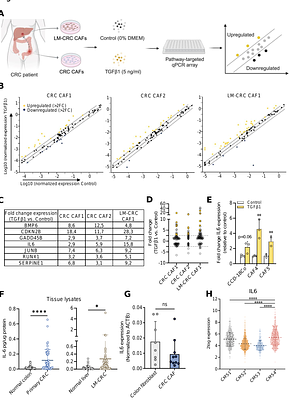 TGFβ signaling in cancer-associated fibroblasts drives a hepatic gp130-dependent pro-metastatic inflammatory program in CMS4 colorectal cancer subtype