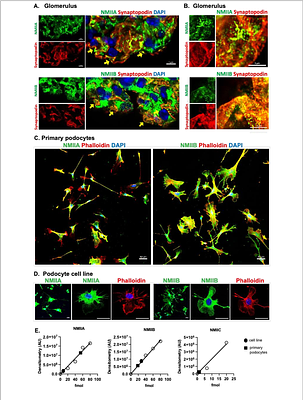 WNK1 kinase activity is required for maintenance of podocyte structure