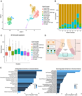 A Catalytically Inactive Protein Kinase C alpha Mutation Drives Chordoid Glioma by Pathway Rewiring