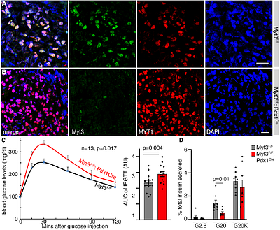 Deregulated Myt3 translation predisposes islet β-cells to dysfunction under obesity-induced metabolic stress