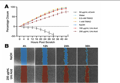 Metabolic Analysis of Human Retinal Pigment Epithelium and Choroid Tissue in Aging and Macular Degeneration