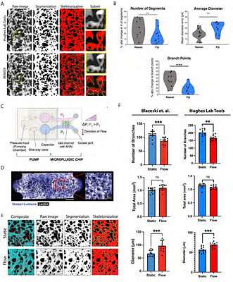 Methods for Processing and Analyzing Images of Vascularized Micro-Organ and Tumor Systems