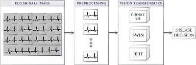 Heart Disease Detection using Vision-Based Transformer Models from ECG
  Images