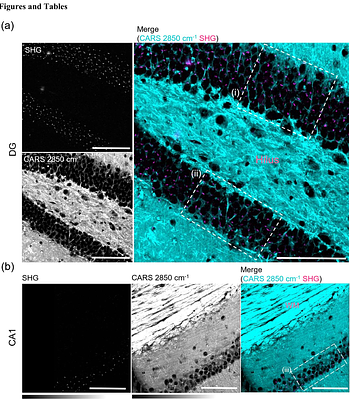Label-free visualization of ciliary rootlets in mouse brain