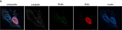Myogenic dedifferentiation involves a p53-dependent reorganization of PLK4 localization during centrosome regeneration