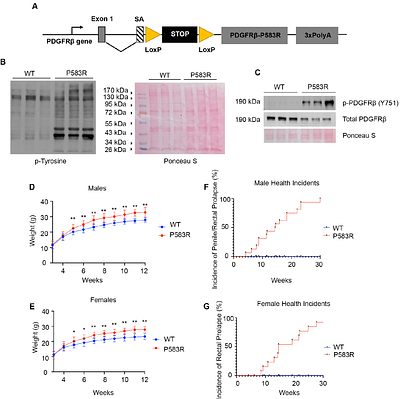Connective tissue growth in a mouse model of Kosaki overgrowth syndrome is limited by STAT1