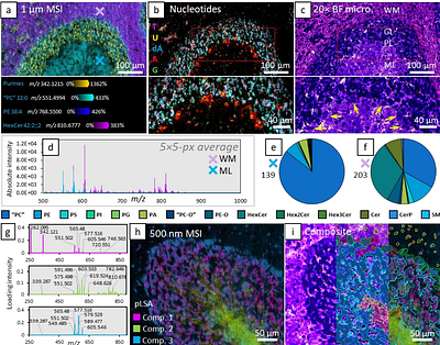 Subcellular mass spectrometry imaging of lipids and nucleotides using transmission geometry ambient laser desorption and plasma ionisation