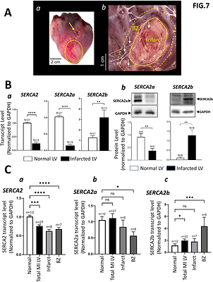 Increased spontaneous Ca2+ activity in Cardiac Purkinje cells after myocardial infarction; A consequence of a dramatic shift of SERCA isoforms as potential adaptation to acute ischemia?