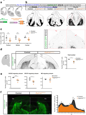 Interneuron migration defects during corticogenesis contribute to Dyrk1a haploinsufficiency syndrome pathogenesis via actomyosin dynamics deregulations
