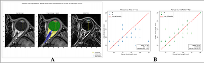 A-eye: Automated 3D Segmentation of Healthy Human Eyeand Orbit Structures and Axial Length Extraction