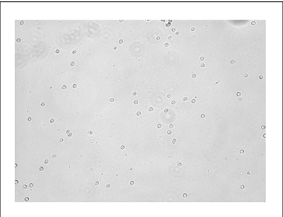Protective effects of a novel RIPK3 antagonist against neutrophil necroptosis and formation of neutrophil extracellular traps