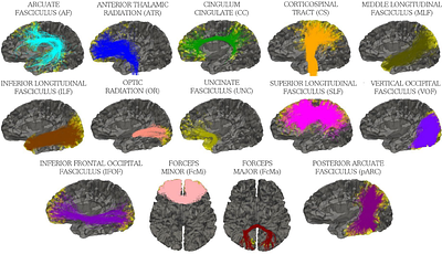 Cortical and white matter T1w/T2w development proceed in concert during early infancy