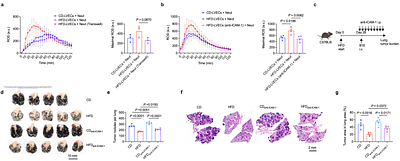 Fat-rich diet reprograms intrapulmonary neutrophils to boost tissue-specific antitumor immunity