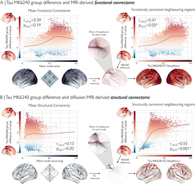 In-vivo evidence for increased tau deposition in temporal lobe epilepsy