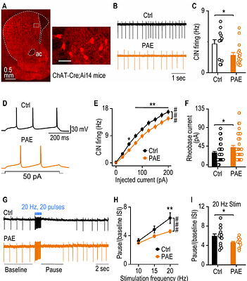 Prenatal Alcohol Exposure Impairs Striatal Cholinergic Function and Cognitive Flexibility in Adult Offspring