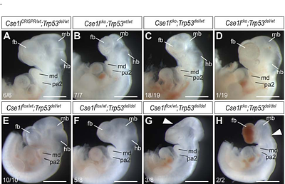 Cse1l Regulates Neural Crest Cell Survival and is Critical for Craniofacial and Cardiac Development