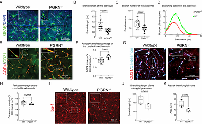 Progranulin haploinsufficiency remodels the cerebral microvasculature and neurovascular unit