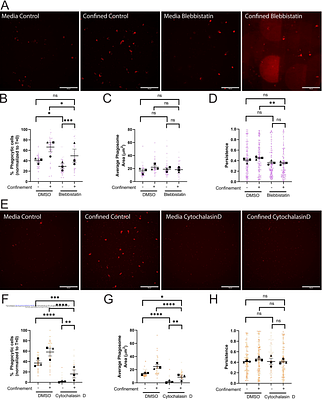 Physical confinement and phagocytic uptake induce directional migration