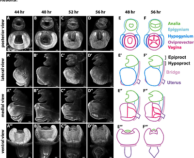 Parallels in the Regulatory Landscape of Dimorphic Female and Male Genital Structures in Drosophila melanogaster
