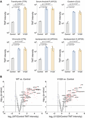3D Visualization and Proteomic Analysis of Human Cardiac Transthyretin Amyloidosis Tissue Reveals Microangiopathy and Capillary Occlusion