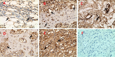 THE COMPARATIVE STUDY OF THE EFFECT OF LOW-INTENSITY BROADBAND AND LOW-INTENSITY PULSED ULTRASOUND ON THE AMPUTATIONAL MODEL OF WOUND