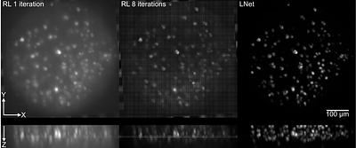 Light-field deep learning enables high-throughput, scattering-mitigated calcium imaging