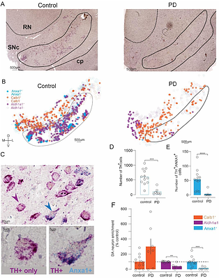 Parkinson's disease-vulnerable and -resilient dopamine neurons display opposite responses to excitatory input