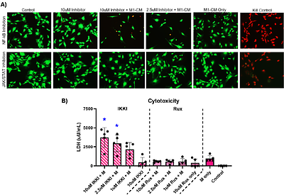 Tendon fibroblast inflammatory responses depend on NF-κβ and JAK/STAT signaling and alter mechanotransduction pathways