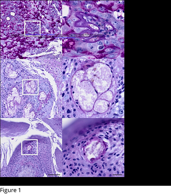 Detection of vasculogenic mimicry in equine ocular, oronasal, and genital squamous cell carcinoma